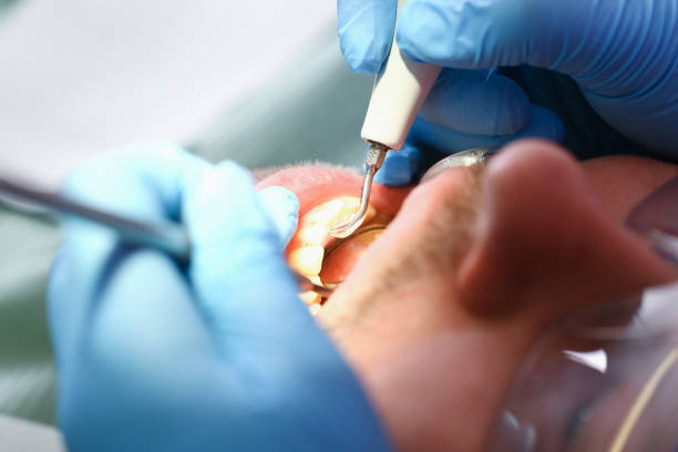 Best Emergency Denture Repair in Minneola, FL